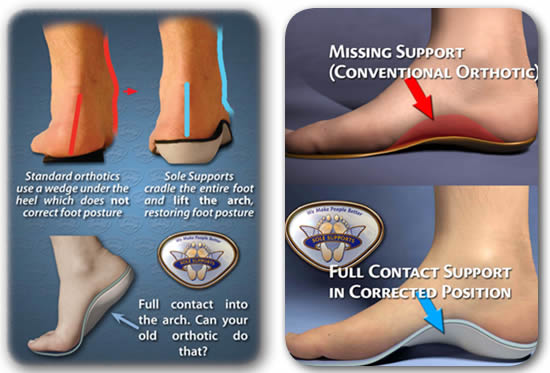 custom made orthotics